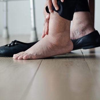 Elderly woman swollen feet putting on shoes